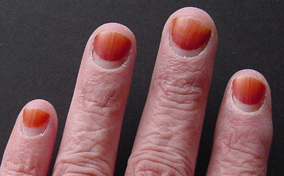Fingernails Grow